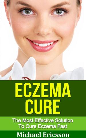 bigCover of the book Eczema Cure: The Most Effective Solution to Cure Eczema Fast by 