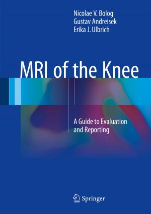 Cover of the book MRI of the Knee by Pamela J. Stewart, Andrew J. Strathern