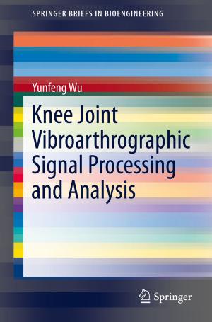 Book cover of Knee Joint Vibroarthrographic Signal Processing and Analysis