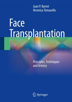 Cover of the book Face Transplantation by Jürgen Friedrich