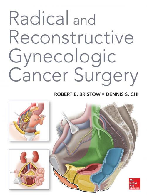 Cover of the book Radical and Reconstructive Gynecologic Cancer Surgery by Robert E. Bristow, Dennis Chi, McGraw-Hill Education