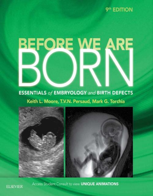 Cover of the book Before We Are Born E-Book by Keith L. Moore, BA, MSc, PhD, DSc, FIAC, FRSM, FAAA, T. V. N. Persaud, MD, PhD, DSc, FRCPath (Lond.), FAAA, Mark G. Torchia, MSc, PhD, Elsevier Health Sciences
