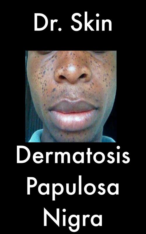 Cover of the book Dermatosis Papulosa Nigra by Dr Skin, Dr Skin