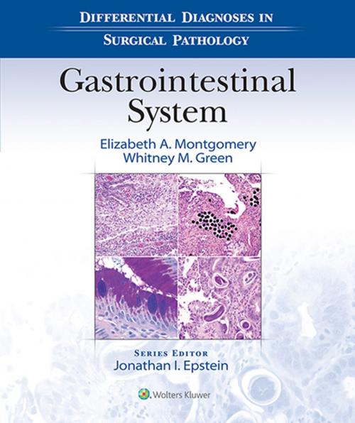 Cover of the book Differential Diagnoses in Surgical Pathology: Gastrointestinal System by Elizabeth A. Montgomery, Whitney M. Green, Wolters Kluwer Health