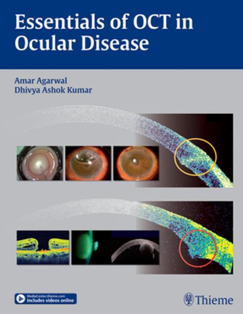 Cover of the book Essentials of OCT in Ocular Disease by , Thieme