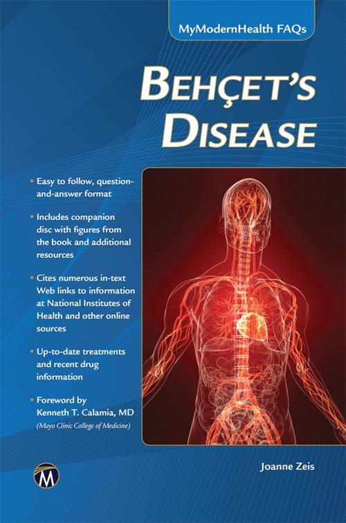 Cover of the book Behcet’s Disease by Joanne Zeis, Mercury Learning & Information