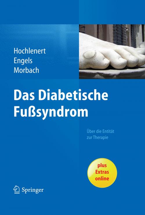 Cover of the book Das diabetische Fußsyndrom - Über die Entität zur Therapie by Dirk Hochlenert, Gerald Engels, Stephan Morbach, Springer Berlin Heidelberg