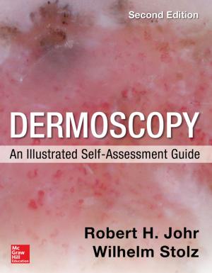 Cover of the book Dermoscopy: An Illustrated Self-Assessment Guide by Peter Navarro