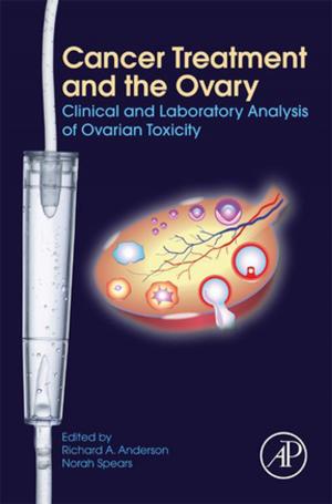 Cover of the book Cancer Treatment and the Ovary by Donald L. Sparks