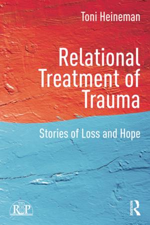 Cover of the book Relational Treatment of Trauma by Ronald Davie, David M. Galloway
