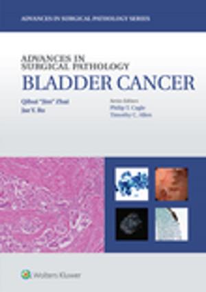 Cover of the book Advances in Surgical Pathology: Bladder Cancer by Matthew Davenport