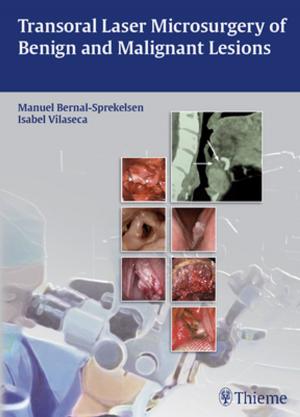 Cover of the book Transoral Laser Microsurgery of Benign and Malignant Lesions by Homayoun Tabandeh, Morton F. Goldberg