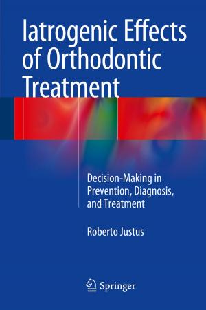Cover of the book Iatrogenic Effects of Orthodontic Treatment by John Edington