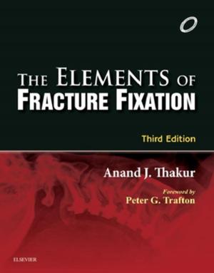 Book cover of Elements of Fracture Fixation - E-book