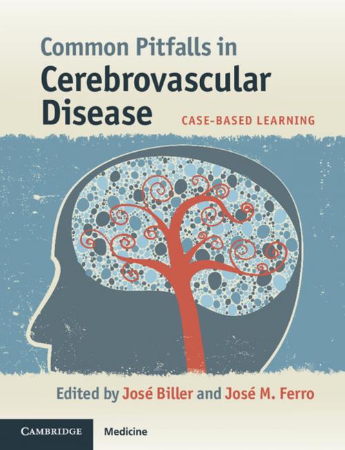 Cover of the book Common Pitfalls in Cerebrovascular Disease by , Cambridge University Press