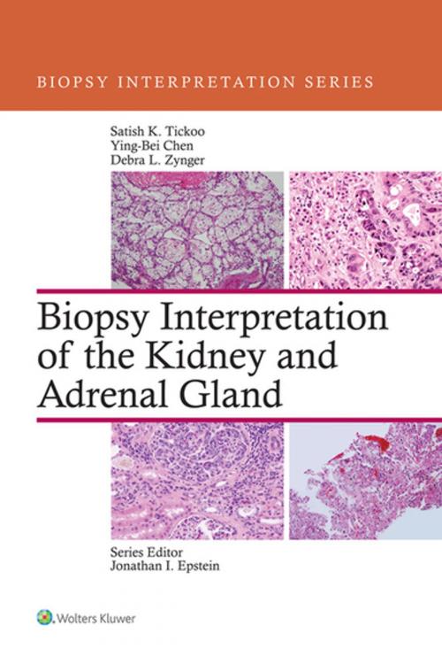Cover of the book Biopsy Interpretation of the Kidney & Adrenal Gland by Satish Tickoo, Ying-bei Chen, Debra Zynger, Wolters Kluwer Health
