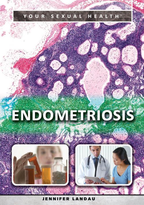 Cover of the book Endometriosis by Jennifer Landau, The Rosen Publishing Group, Inc