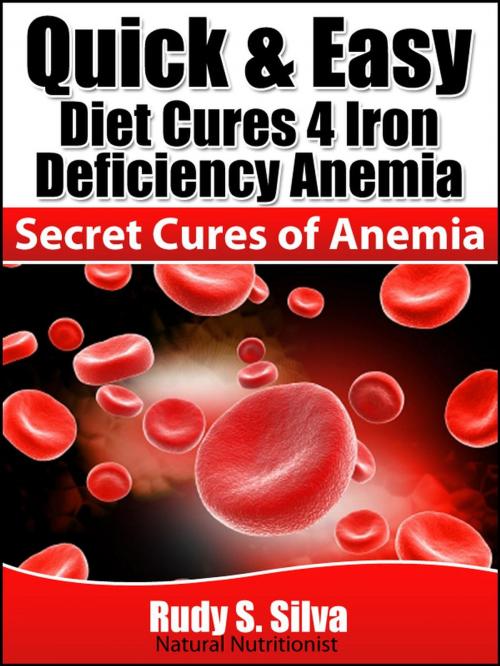 Cover of the book Quick and Easy Diet Cures 4 Iron Deficiency Anemia by Rudy Silva, Rudy Silva