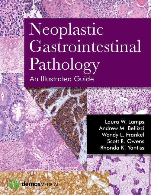 Cover of the book Neoplastic Gastrointestinal Pathology: An Illustrated Guide by Laura Lamps, MD, Andrew Bellizzi, MD, Scott R. Owens, MD, Rhonda Yantiss, MD, Wendy L. Frankel, MD, Springer Publishing Company