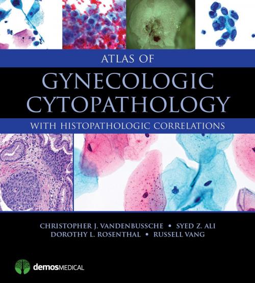 Cover of the book Atlas of Gynecologic Cytopathology by Christopher J. VandenBussche, MD, PhD, Syed Z. Ali, MD, FRCPath, FIAC, Russell Vang, MD, Dorothy L. Rosenthal, MD, FIAC, Springer Publishing Company