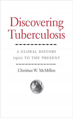 Cover of the book Discovering Tuberculosis by Ronald K.L. Collins and David M. Skover