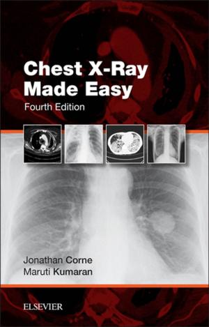 Cover of the book Chest X-Ray Made Easy E-Book by Mary Ann E. Zagaria, PharmD