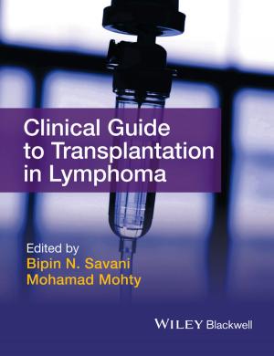 Cover of the book Clinical Guide to Transplantation in Lymphoma by Michel Soustelle