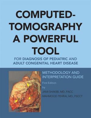 Cover of the book Computed-Tomography a Powerful Tool for Diagnosis of Pediatric and Adult Congenital Heart Disease by Dalvin Clifford