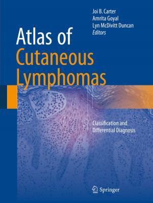 Cover of the book Atlas of Cutaneous Lymphomas by Lena C. Zuchowski