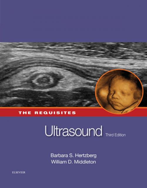 Cover of the book Ultrasound: The Requisites E-Book by Barbara S. Hertzberg, MD, FACR, William D. Middleton, MD, FACR, Elsevier Health Sciences