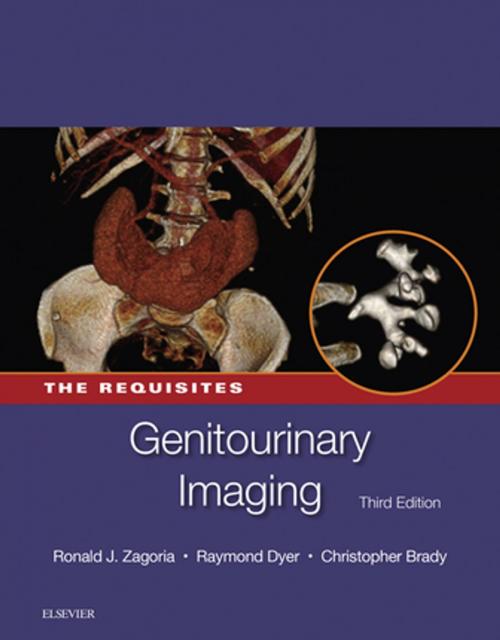 Cover of the book Genitourinary Imaging: The Requisites E-Book by Ronald J. Zagoria, MD, FACR, Christopher M Brady, MD, Raymond B. Dyer, MD, Elsevier Health Sciences