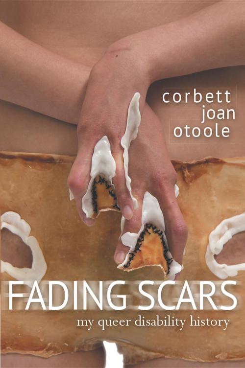 Cover of the book Fading Scars: My Queer Disability History by Corbett Joan OToole, Elizabeth Grace, Autonomous Press