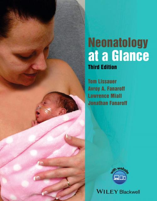 Cover of the book Neonatology at a Glance by Tom Lissauer, Avroy A. Fanaroff, Lawrence Miall, Jonathan Fanaroff, Wiley