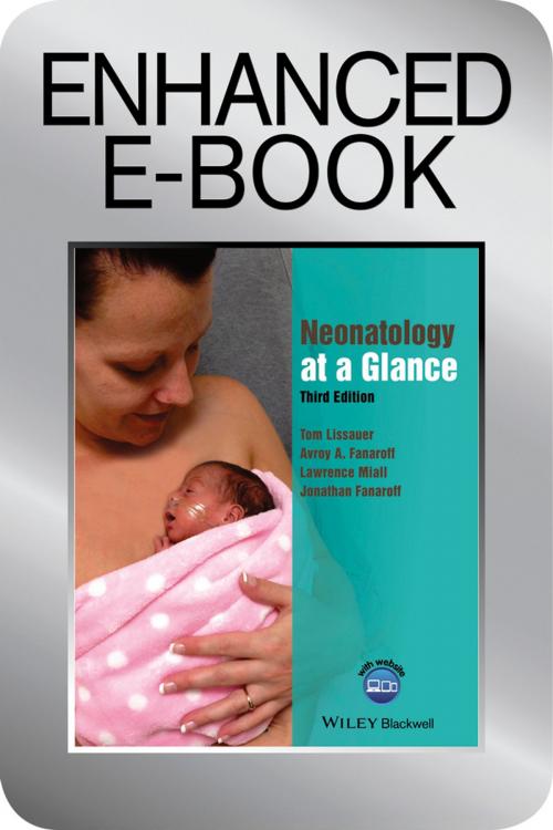 Cover of the book Neonatology at a Glance by Tom Lissauer, Avroy A. Fanaroff, Lawrence Miall, Jonathan Fanaroff, Wiley