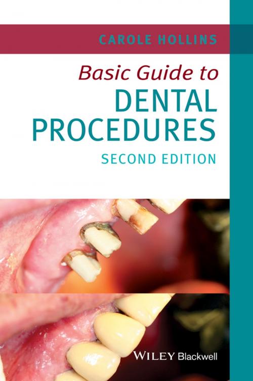 Cover of the book Basic Guide to Dental Procedures by Carole Hollins, Wiley