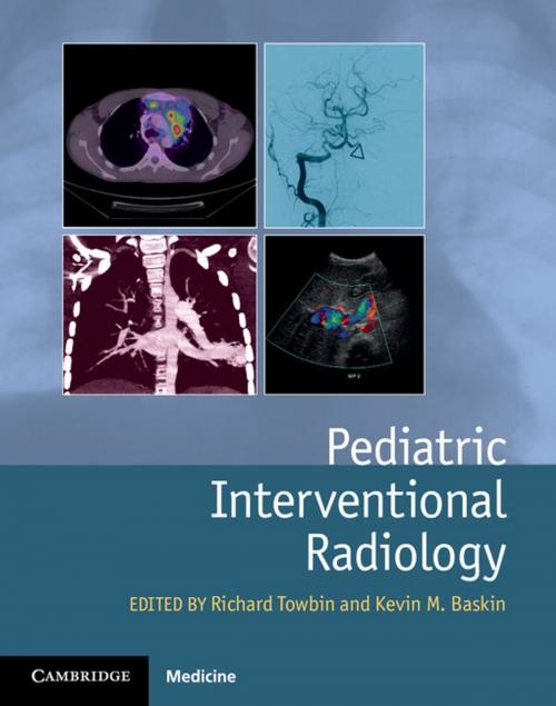 Cover of the book Pediatric Interventional Radiology by , Cambridge University Press
