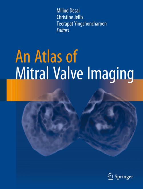 Cover of the book An Atlas of Mitral Valve Imaging by , Springer London