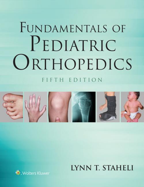 Cover of the book Fundamentals of Pediatric Orthopedics by Lynn T. Staheli, Wolters Kluwer Health