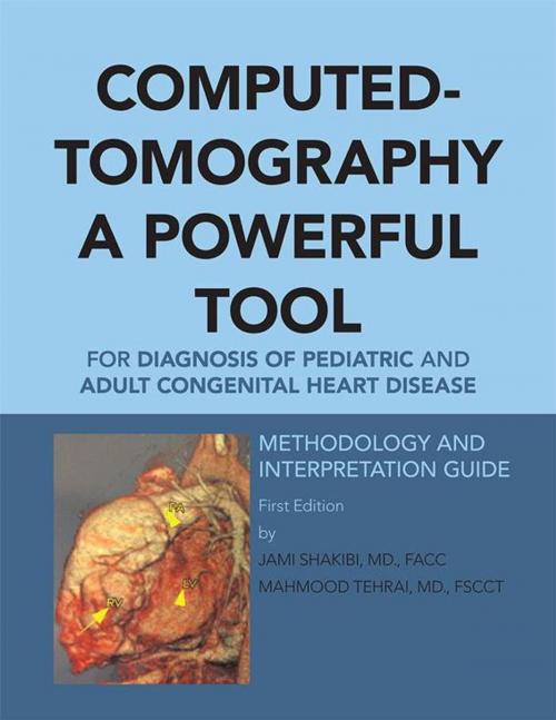 Cover of the book Computed-Tomography a Powerful Tool for Diagnosis of Pediatric and Adult Congenital Heart Disease by Jami G. Shakibi, AuthorHouse