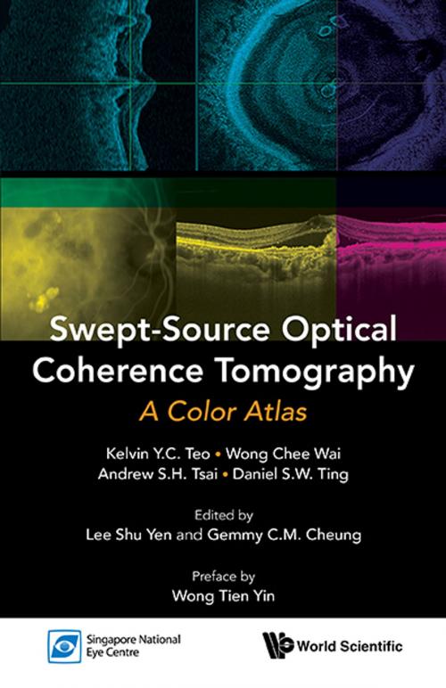 Cover of the book Swept-Source Optical Coherence Tomography by Kelvin Y C Teo, Chee Wai Wong, Andrew S H Tsai;Daniel S W Ting;Shu Yen Lee;Gemmy C M Cheung, World Scientific Publishing Company