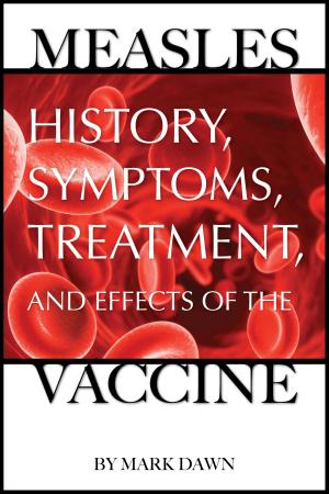 Book cover of Measles: History, Symptoms, Treatment, and Effects of the Vaccine