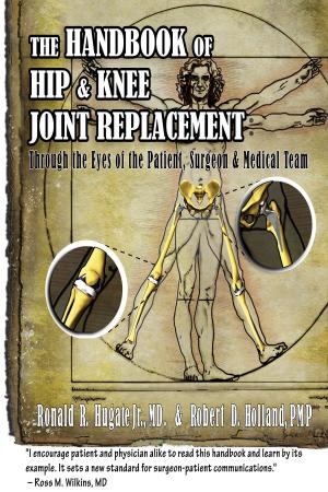 Book cover of Handbook of Hip & Knee Joint Replacement: Through the Eyes of the Patient, Surgeon & Medical Team