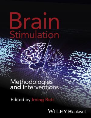 Cover of the book Brain Stimulation by William Harmon