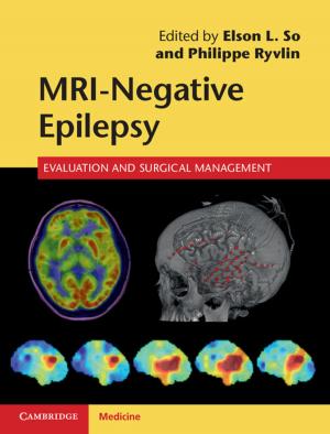Cover of the book MRI-Negative Epilepsy by 