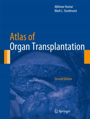 Cover of the book Atlas of Organ Transplantation by Yong Shi, Yingjie Tian, Gang Kou, Yi Peng, Jianping Li