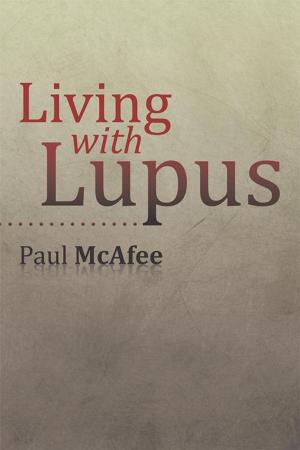 Cover of the book Living with Lupus by James Osbon