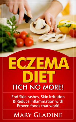 Book cover of Eczema Diet: Itch No More! End Skin rashes, skin irritation & reduce inflammation with A Low Inflammation Diet & Proven foods that work! BONUS know what to avoid!