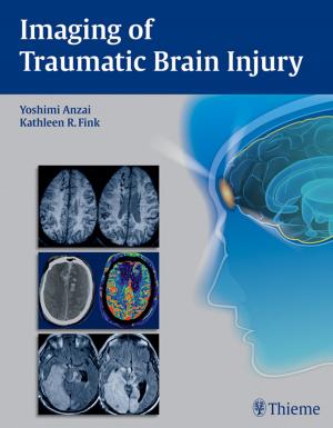 bigCover of the book Imaging of Traumatic Brain Injury by 