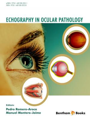 Cover of the book Echography in Ocular Pathology by Robert F. Diegelmann