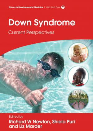 Cover of the book Down Syndrome: Current Perspectives by Richard W Newton, Liz Marder, Shiela C Puri